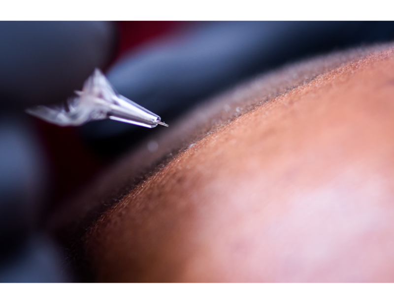 Formation en tricopigmentation à Lyon et Marseille