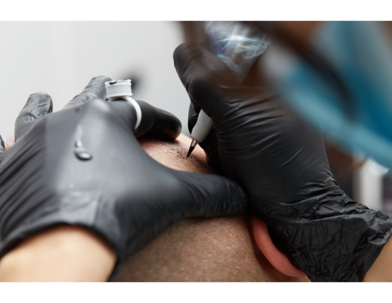 Scalpigmentation à Lyon