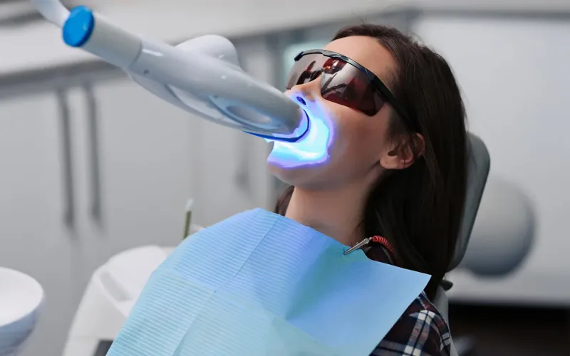 Formation pour découvrir les secrets du blanchiment dentaire en région Rhône Alpes