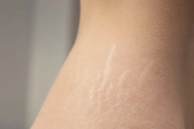 Formation Skinrepair, Reconstruction