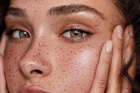 Formation pour acquérir de nouvelles compétences en dermopigmentation des taches de rousseur à Lyon