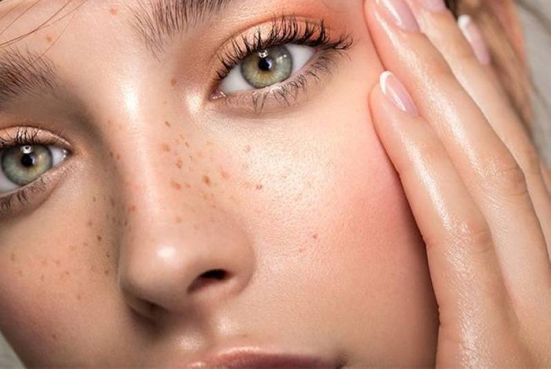 Formation pour devenir un(e) expert(e) en dermopigmentation des taches de rousseur à Marseille