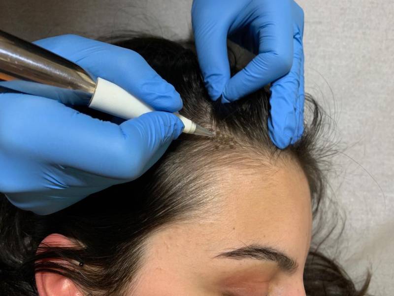 Formation en maquillage permanent du cuir chevelu et découvrir la Tricopigmentation/ Scalp pigmentation à Lyon